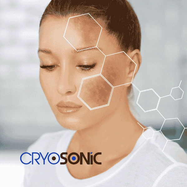Are you looking for age spot removal treatment? Contact Cryosonic today in Folkestone