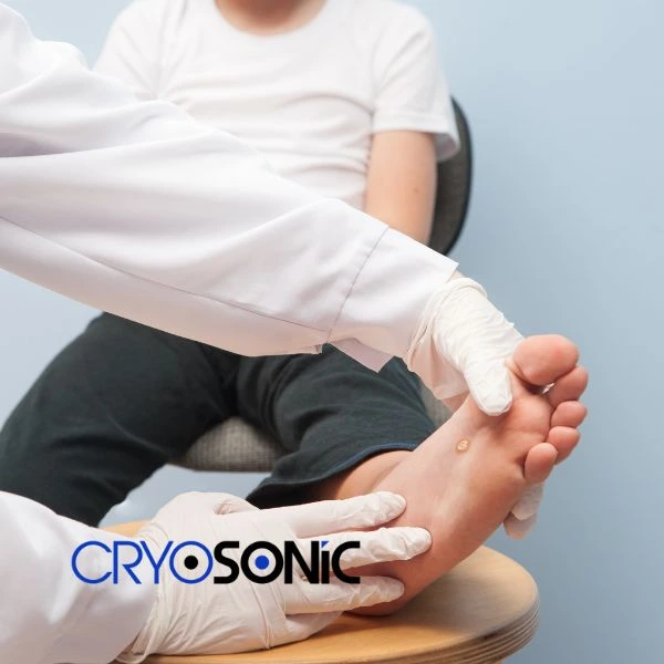 Are you looking for fast effective wart removal Contact us today Folkestone